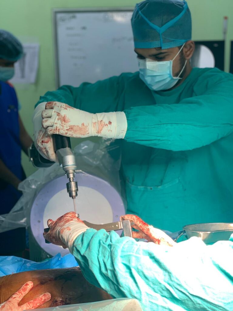 Performing fracture Surgery