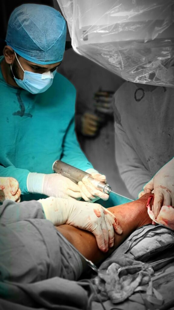 Dr Shivam Rampal performing Femur Fracture Surgery.